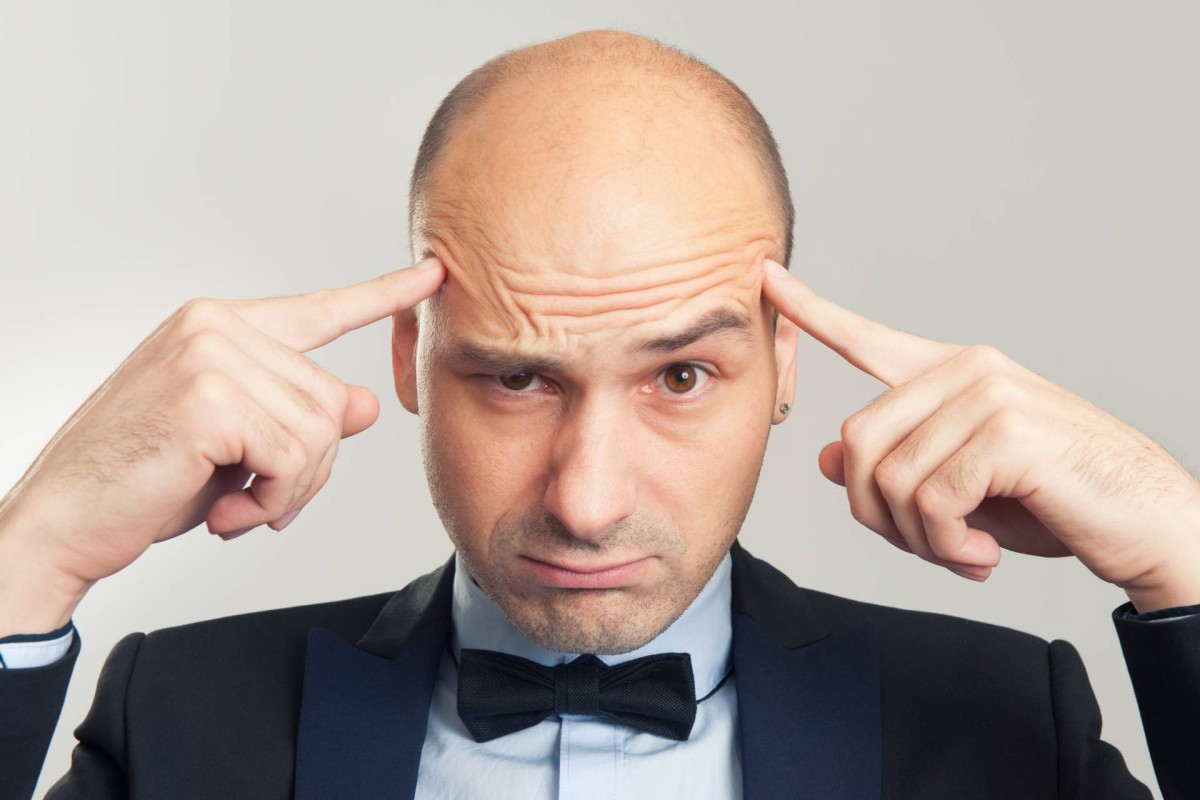 Embracing your baldness